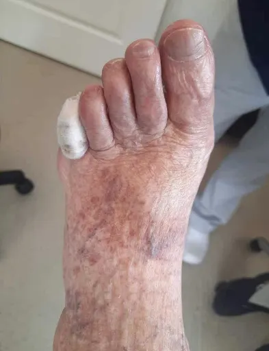 Akademia Zdrowej Stopy Podolog Katarzyna Wajs